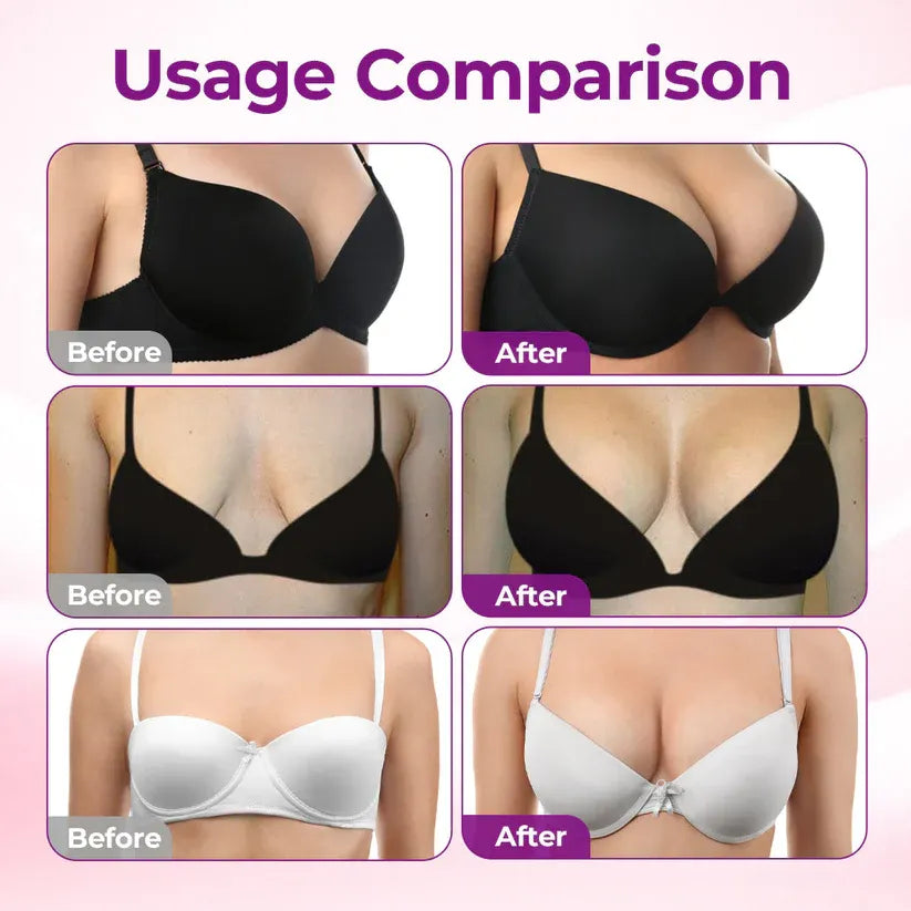 💥NEYEROS® 💥Targeted Breast Enhancement Advanced Nano Microneedle Patch💥💥💥